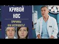 КРИВОЙ НОС 🤥 КРИВАЯ ПЕРЕГОРОДКА НОСА: КАК ВЫРОВНЯТЬ?