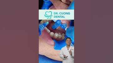 Cách khắc phục hàm răng thưa |Dr Cường Offical #drcuong #shorts