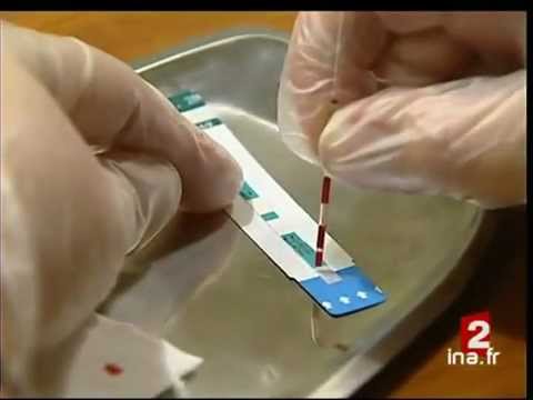 Vidéo: Test De Dépistage Du VIH à Domicile: Vérifiez Votre Statut VIH Avec Le Test Rapide Du VIH