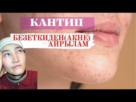 Video: Кашты кетирүүнүн 3 жолу