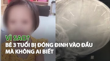 Vì sao Bé 3 tuổi bị đóng đinh vào đầu mà không ai biết?| VTC14