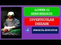 DIVERTICULAR DISEASE-  How To DIAGNOSE & TREAT/  Lower GI Hemorrhage- Acute LLQ Pain