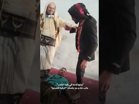 دهس عنق شاب خلال جلسة رقية شرعية في اليمن