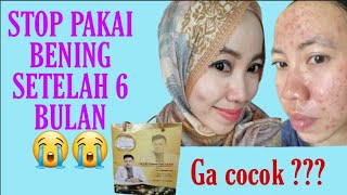 NATASHA SKINCARE | PERTAMA KALI | BIAYANYA | REVIEW