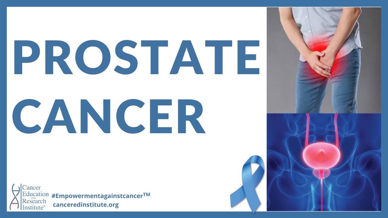 What Are The First Signs Of Prostate Cancer Prostate Cancer Symptoms