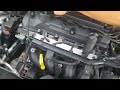 Remplacement Du Kit Chaîne Distribution Avec Pompe à Eau KIA Picanto Hyundai Gand I10 Rio 3 1 2 VVT 