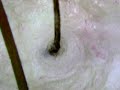 [GOKO]40代前半男性頭皮毛根と毛細血管 GOKO Bscan-Z毛細血管スコープで鮮明に撮影