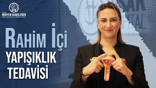 Rahim İçi Yapışıklık Tedavisi