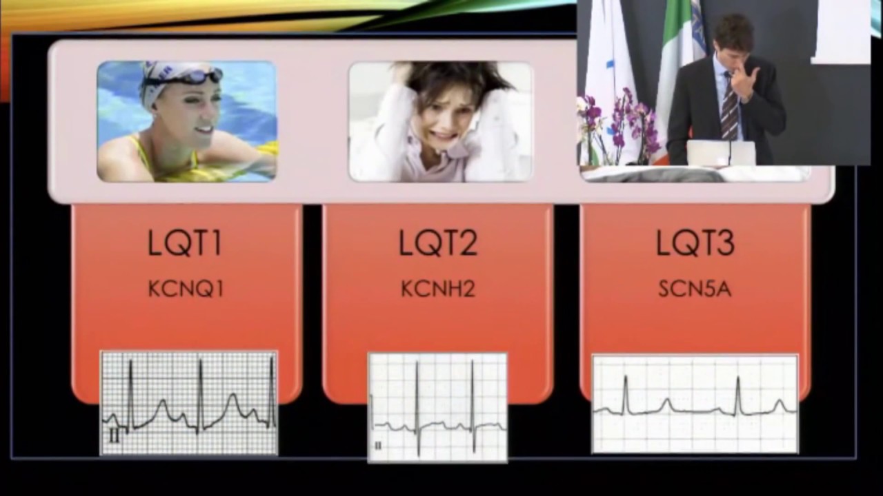 Other ECG abnormalities: Q wave, LAD, LAE, RBBB. How to manage? G.Finocchiaro