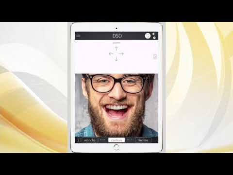 all-on-four-dental-implants-rocky-river-oh-|-dental-implants-cleveland