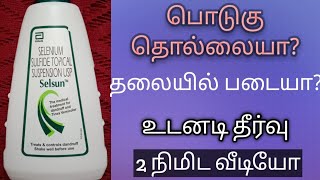 selsun anti dandruff shampoo review tamil | best anti dandruff shampoo | dandruff permanent solution