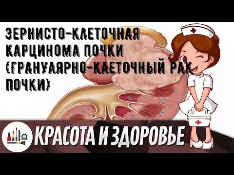 Зернисто-клеточная карцинома почки (Гранулярно-клеточный рак почки)