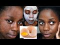 Kuondoa CHUNUSI Usoni na MAKOVU kwa haraka | How to get rid of acne