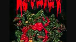 autopsy-twisted mass of burnt decay