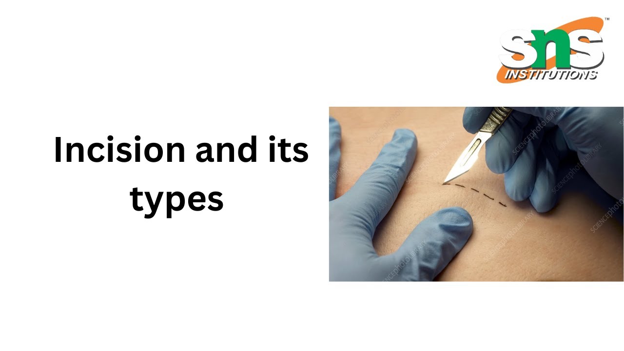 Syntax Autopsy Incision Types Types of Incision | Introduction to Surgery | SNS Institutions - YouTube
