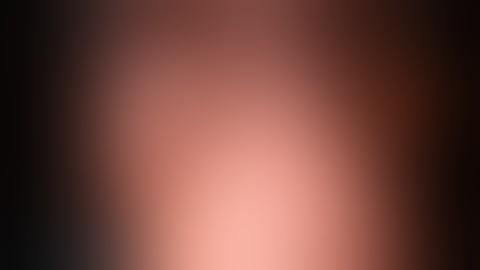 Cerfolio Surgery: Left Lower Lobe Segmemts 7, 8, 9, 10