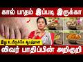 7 நாளில் அதிசயம் நெய் குடிப்பதால் நடக்கும் மாற்றம் | 7 Days Challenge Detox Your Liver | Mr ladies