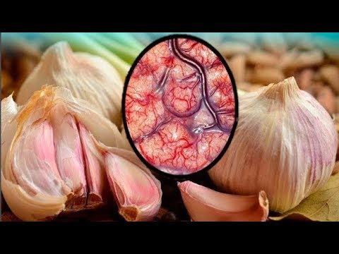 فيديو: ما هو الثوم البري المفيد للإنسان