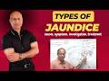 Jaundice - Causes, Symptoms & Treatment