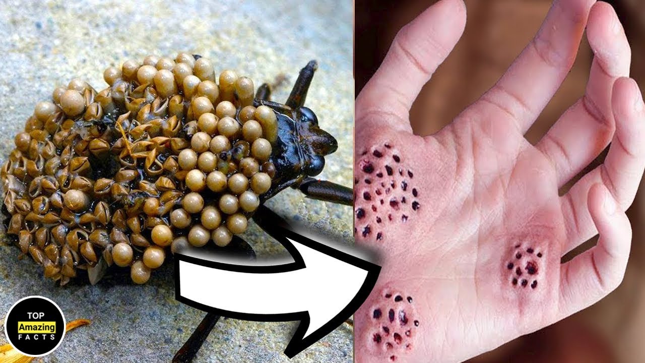 Rotten Insect IT MAKE YOUR SKIN ROTTEN | How Dangerous A Insect Stings Can Be ...
