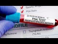 Why Black men should get screened early for prostate cancer