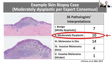 Diagnostic Accuracy and the Potential of AI