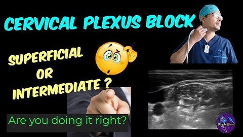 SUPERFICIAL CERVICAL PLEXUS BLOCK 🔴🔴 ULTRASOUND-GUIDED 🔴🔴 LANDMARK & LOR 🔴🔴 TIPS & TRICKS