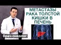 Рак толстой кишки - метастазы рака толстой кишки в печень. Врач-онколог Владимир Лядов