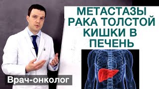 Рак толстой кишки - метастазы рака толстой кишки в печень. Врач-онколог Владимир Лядов