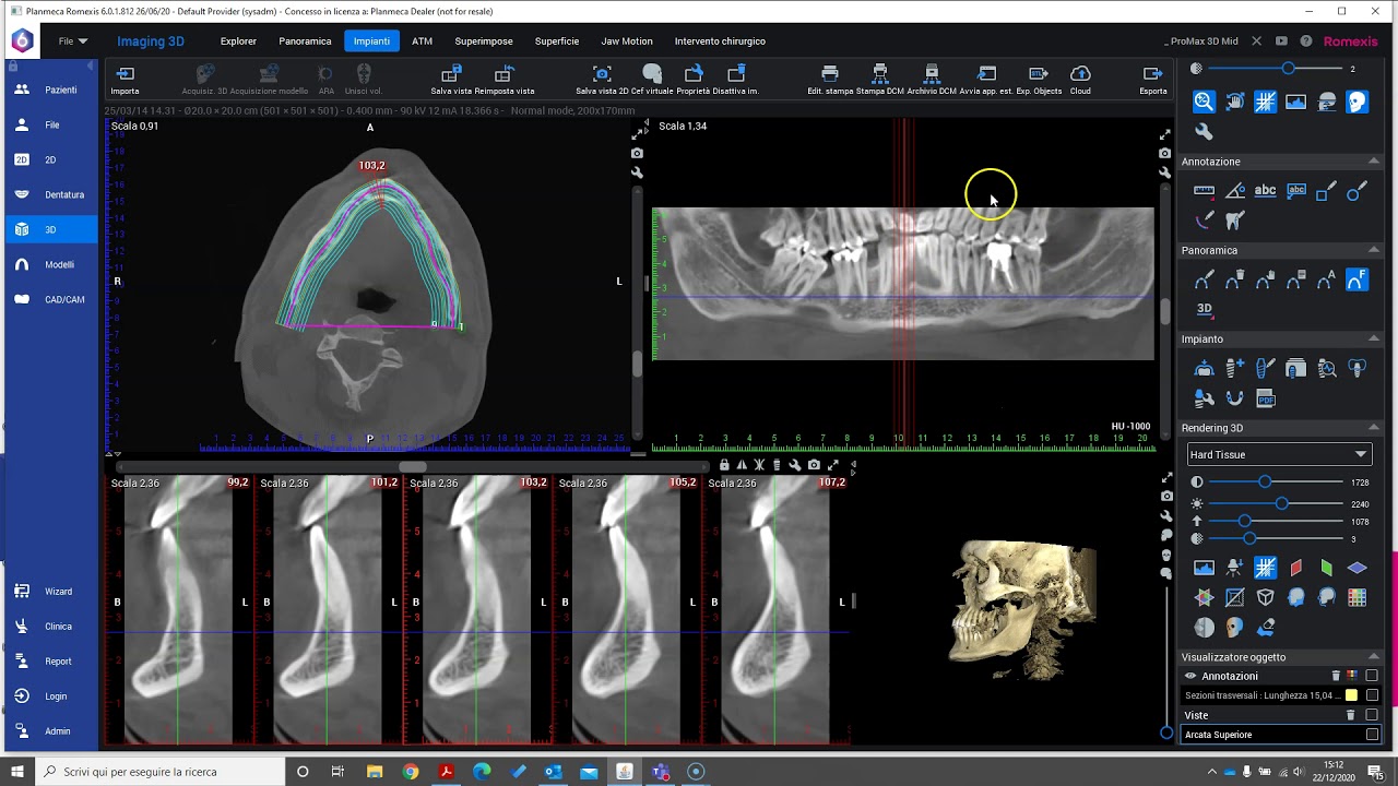 Creazione Dental Scan, Viewer e stampa Dicom