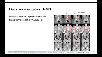 [머신러닝 시스템 설계] 08 - Data augmentation, Learned features vs. engineered features