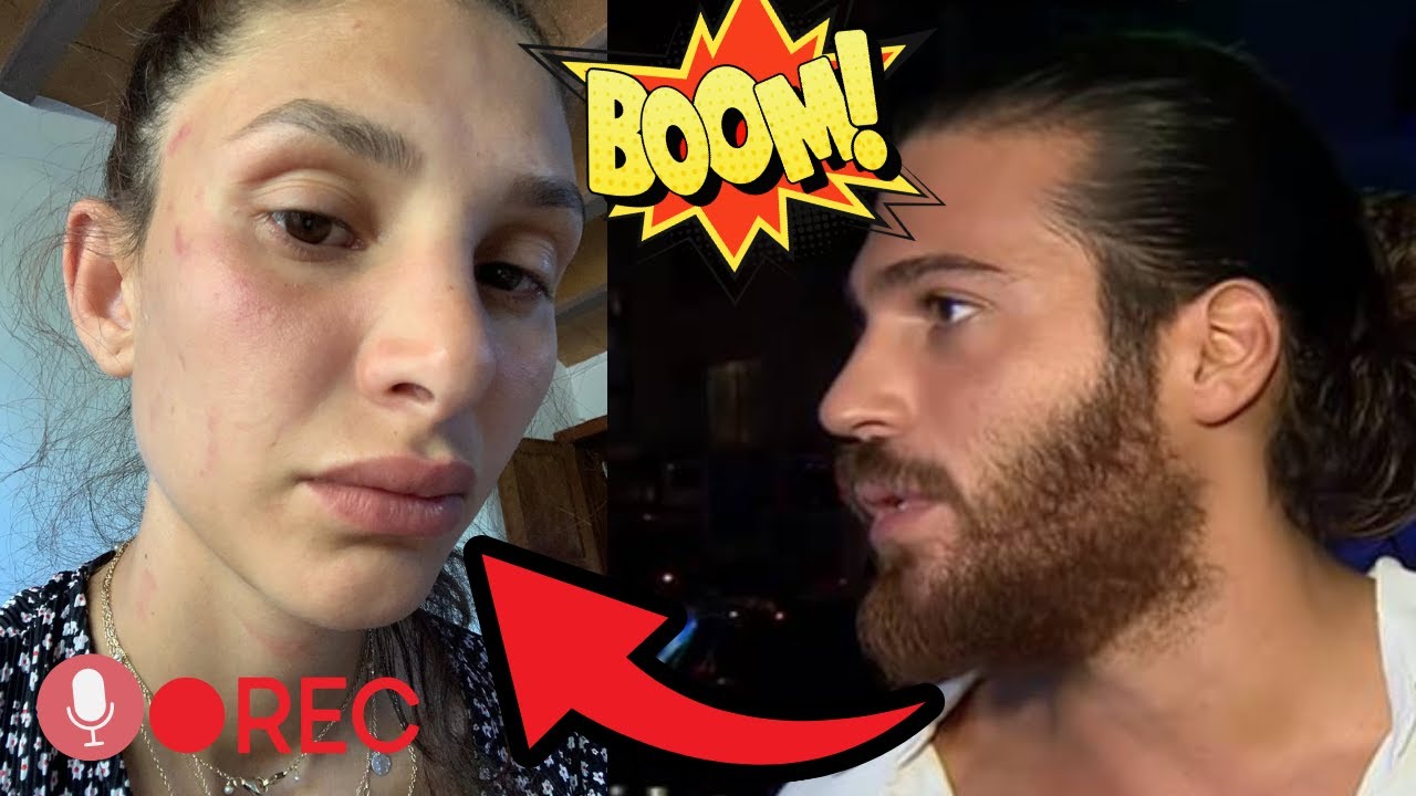 Can Yaman Had A Nervous Breakdown After Listening To Sara's Secret Audio Recordings !