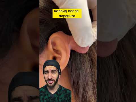 ужасные осложнения после пирсинга