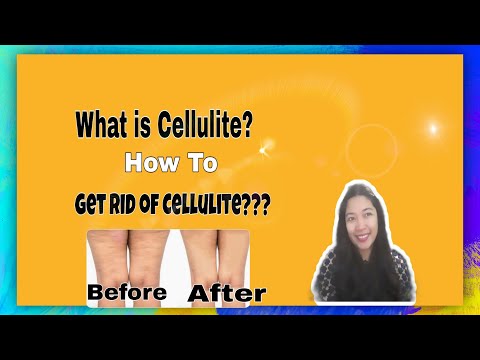 Video: 4 na paraan upang mapupuksa ang Cellulite