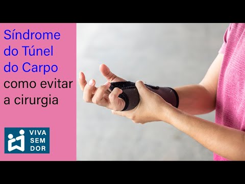 Síndrome do túnel do carpo, como evitar a cirurgia.