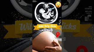 Fetal Movement In Moms Belly