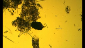 MT_42.mp4 Save the Water Microorganism Microscope Video