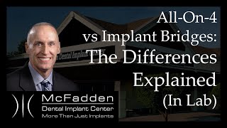 AllOn4 vs. Implant Bridges Explained In The Lab