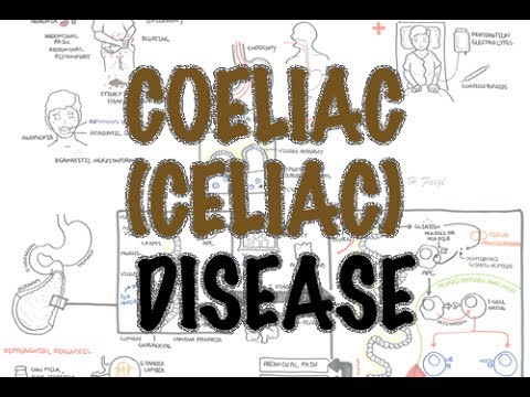 Video: Kas pirmasis atrado celiakiją?