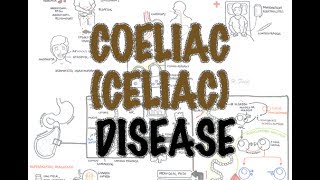 Coeliac (Celiac) Disease  Overview (signs and symptoms, pathophysiology, diagnosis, treatment)