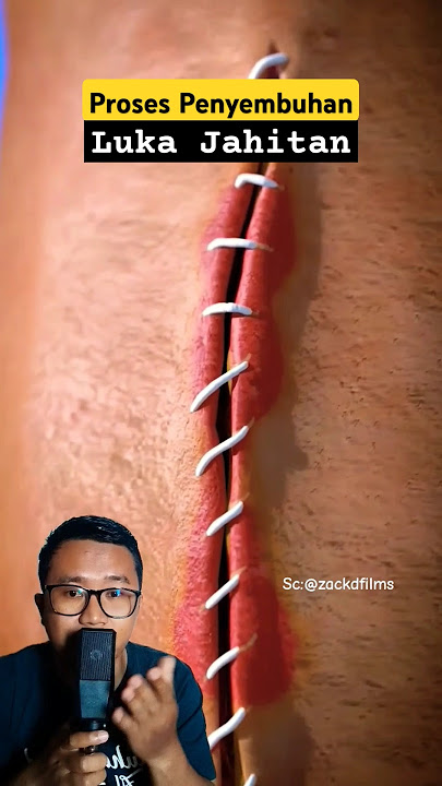 The Process of Healing Stitches. #shorts #education #science #biology