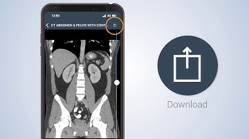 Patient Access Video