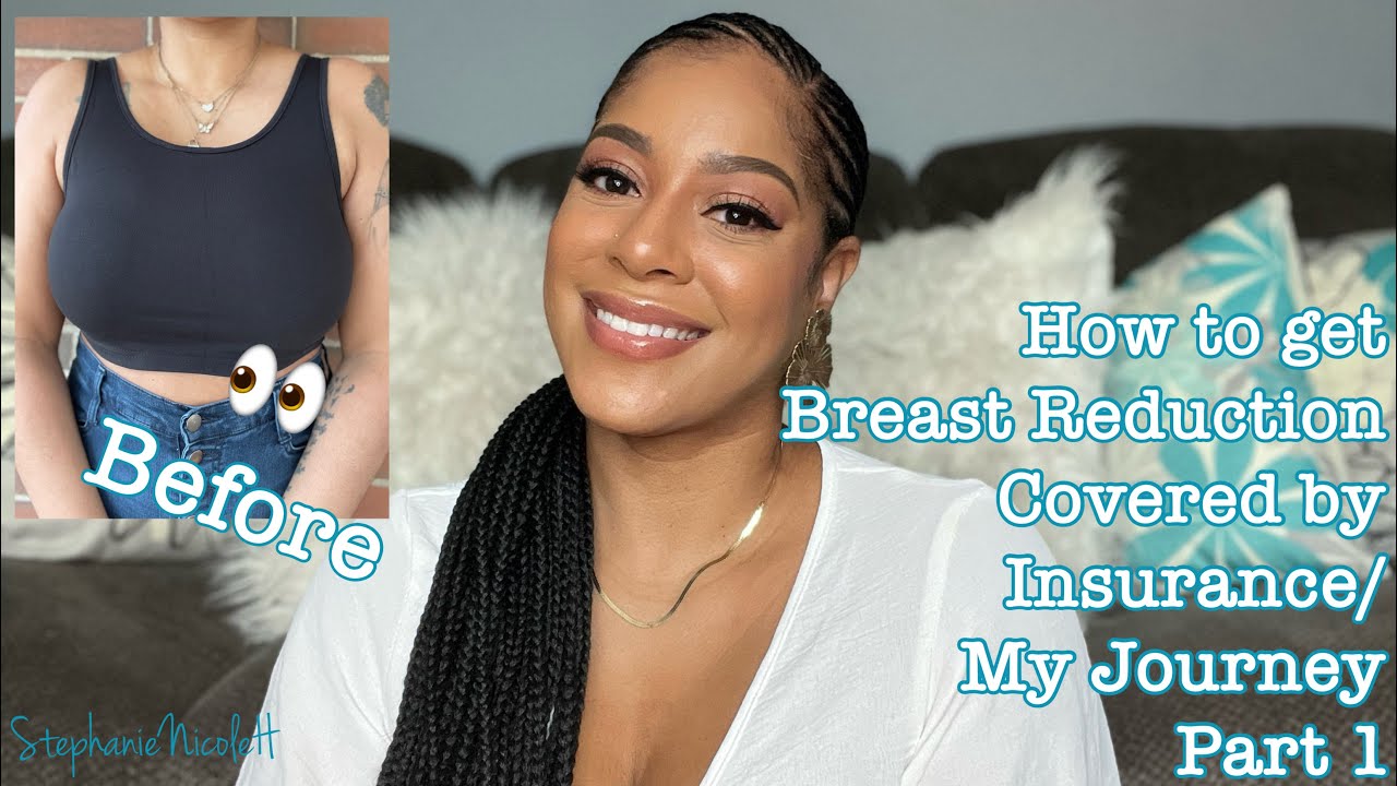 Breast Reduction Before and After: The Procedure, Insurance Coverage, and  Recovery