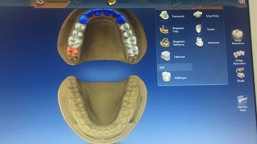 Export dxt to inLab15 through inLab 4.2