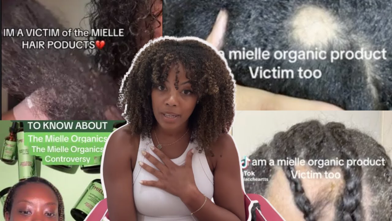 Is Mielle Cosmetics causing EXTREME hair loss?