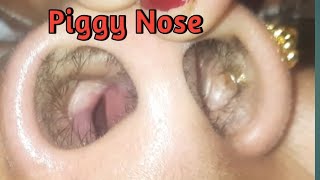 Indian Girl Piggy Nose || Piggy Nose @anushreepaul5625