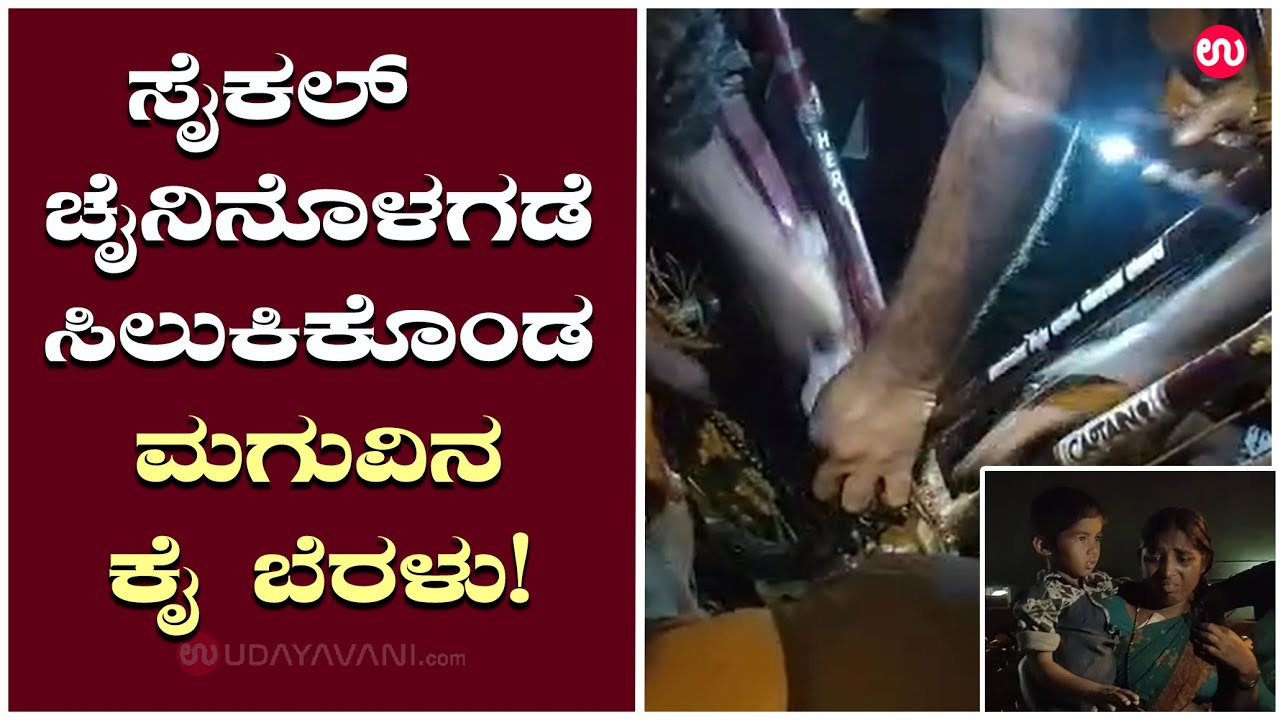 ಸೈಕಲ್ ಚೈನಿನೊಳಗಡೆ ಕೈ ಬೆರಳು ಸಿಲುಕಿಸಿಕೊಂಡ ಮಗು!viralA child with a finger