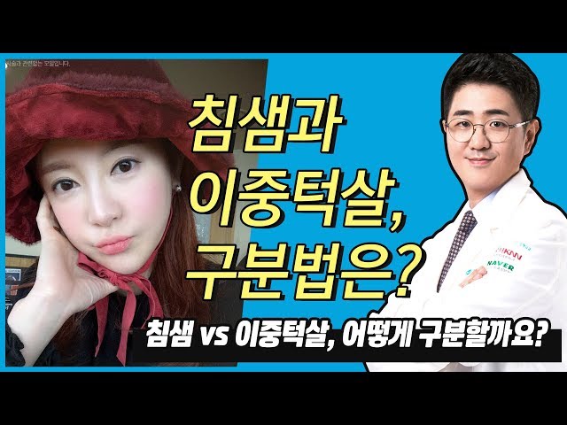 침샘vs이중턱살, 구분은 어떻게 하나요?