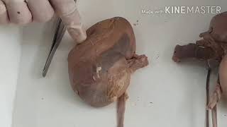 Anatomy of kidney by Dr. Meetu Agarwal screenshot 1