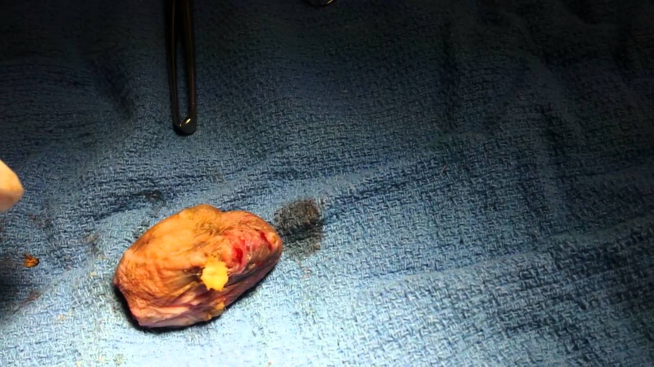 Dog Growth Cyst Abcess Ingrown Hairs 2 Youtube